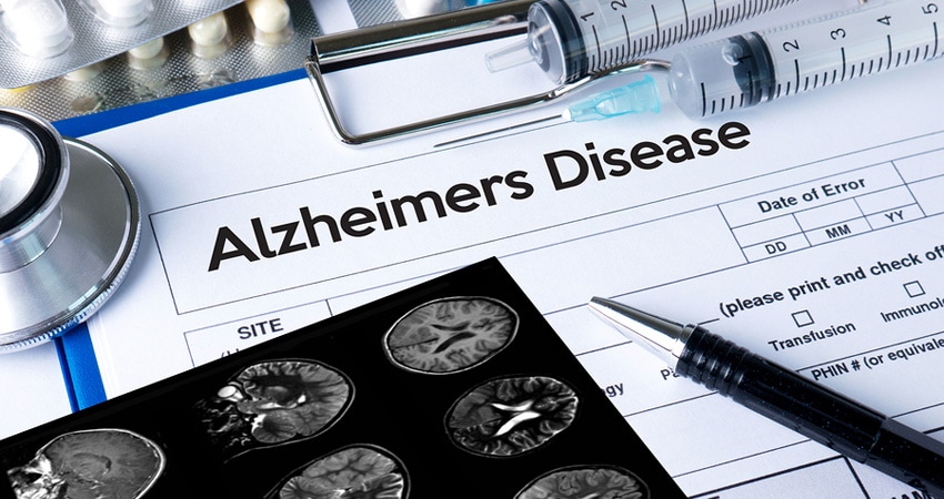 Alzheimers Disease Concept , Brain Degenerative Diseases Parkins